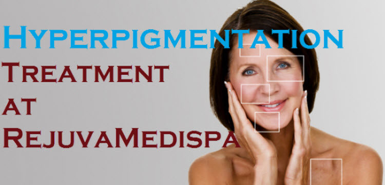 Hyperpigmentation Treatment at RejuvaMedispa, Langley ...