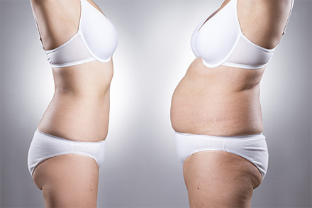 Body Sculpting - Rejuva Medispa & Laser