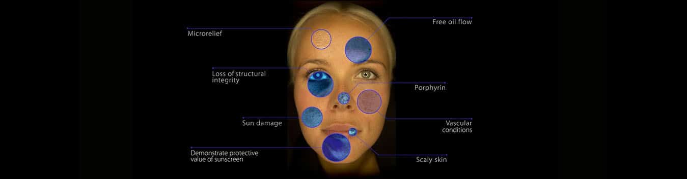 advanced-skin-analysis